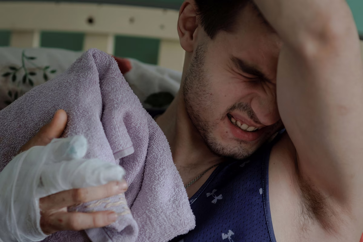 Oleg Smolin reacts on a hospital bed as a nurse treats his wounds after a rocket attack in Chuhuiv outside Kharkiv.
